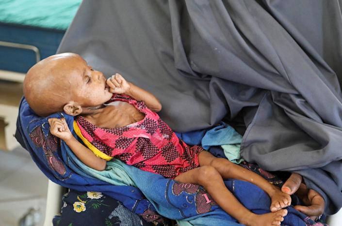 350,000 Somali children at risk of death from climate change-linked drought