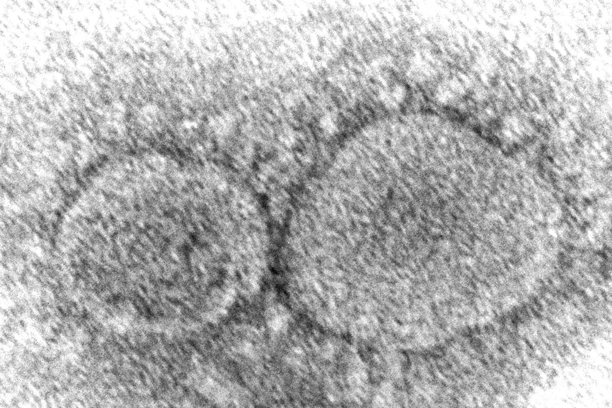 Dominant coronavirus mutant contains ghost of pandemic past