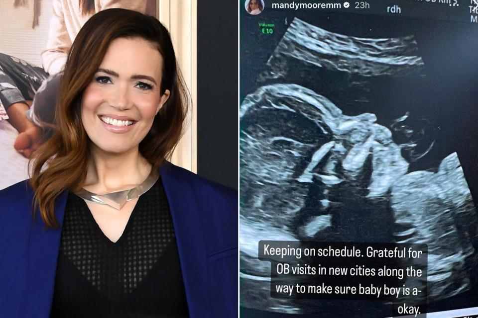 Mandy Moore Cancels Remainder of 2022 Tour Dates amid Pregnancy to Focus on Health and Family