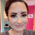 Demi Lovato suffers facial injury caused by a crystal