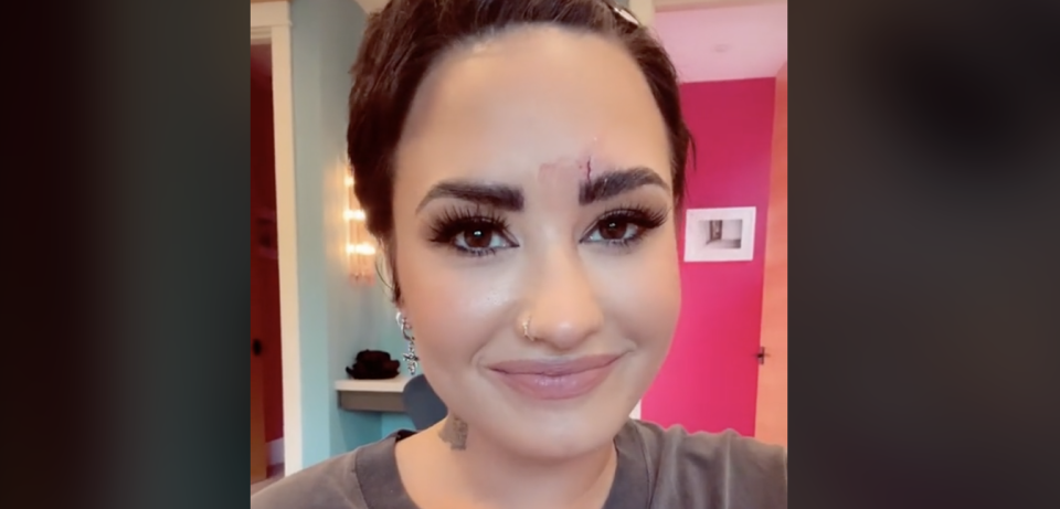 Demi Lovato suffers facial injury caused by a crystal