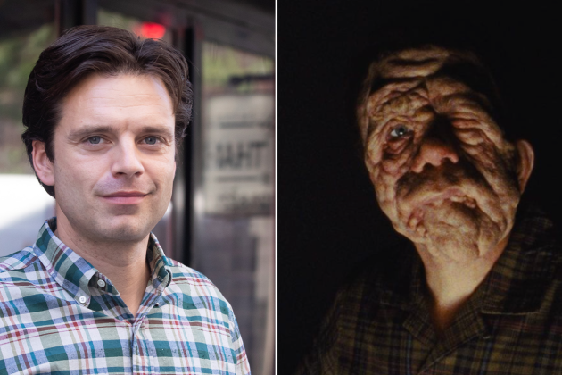 Sebastian Stan Is Unrecognizable in First Look at A24’s ‘A Different Man,’ Stuns Fans With Prosthetics Transformation