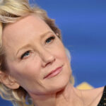 Anne Heche suffered a severe brain injury and ‘is not expected to survive,’ says rep