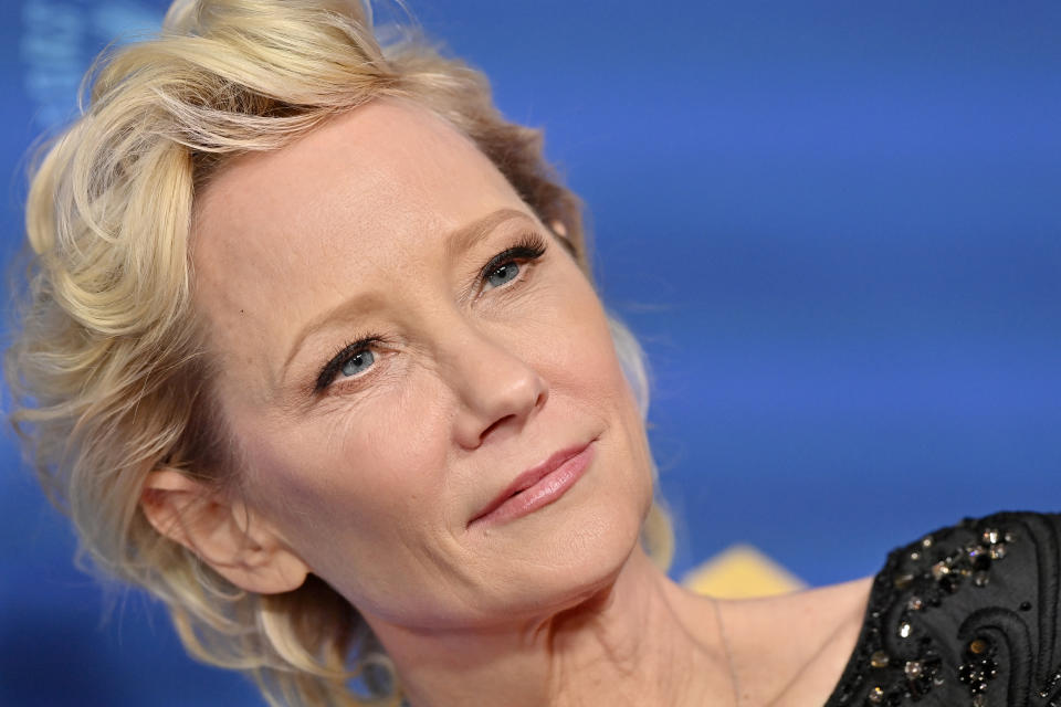 Anne Heche suffered a severe brain injury and ‘is not expected to survive,’ says rep