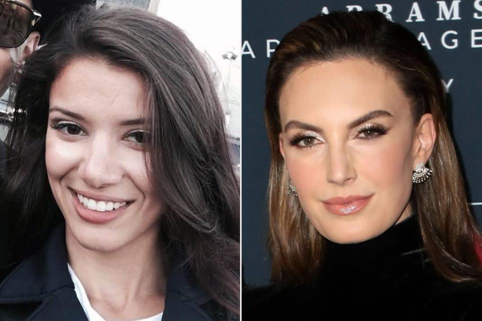 Armie Hammer Accuser Slams Elizabeth Chambers’ New Interview Where She Says Hammer Is ‘Healing’