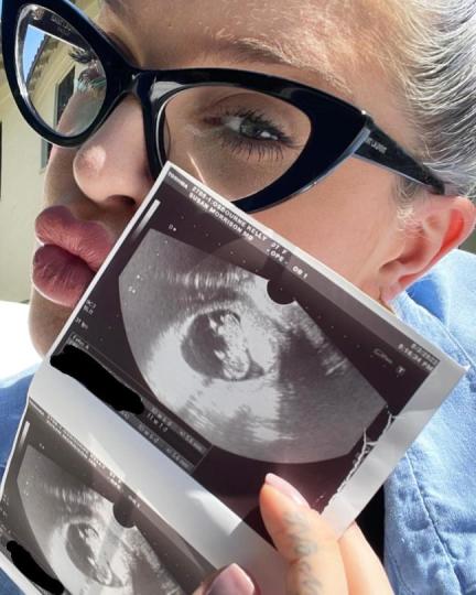 Pregnant Kelly Osbourne Reveals Gestational Diabetes Diagnosis in Third Trimester