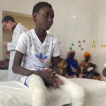 Changing the lives of Senegalese people disabled by clubfoot